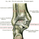 Illustration for article titled Pott’s Fracture or: Tim, Oh My God, I’m So Sorry About Your Leg